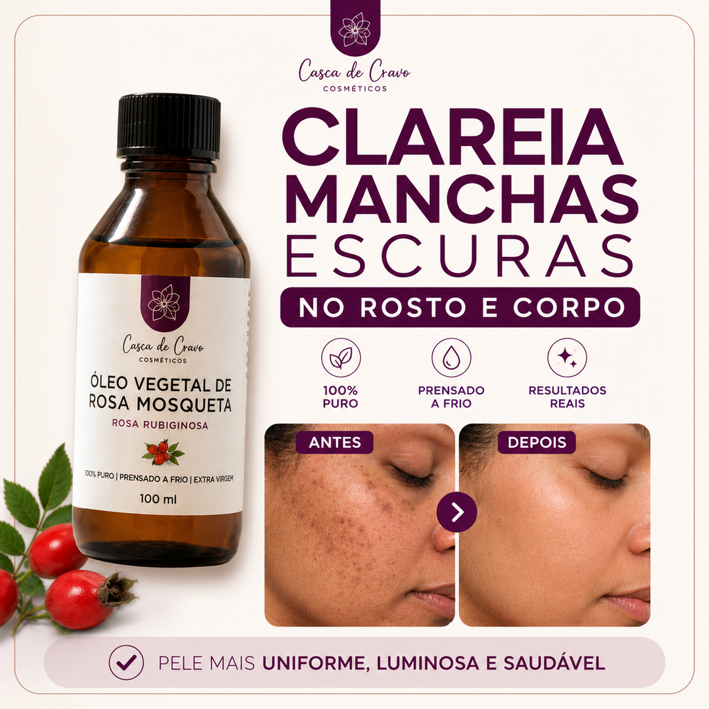 Óleo de Rosa Mosqueta Rubiginosa Puro 100 ml