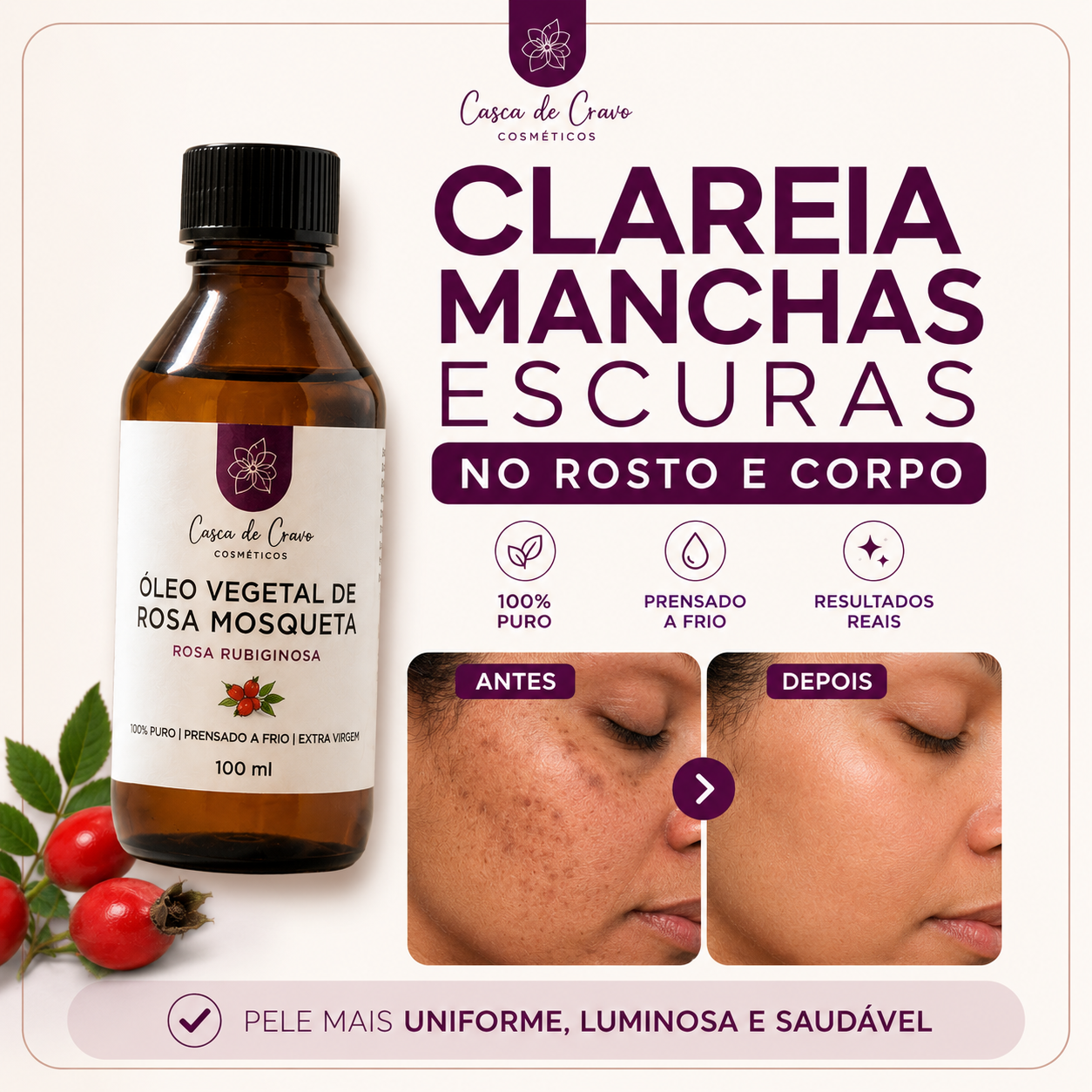 Óleo de Rosa Mosqueta Rubiginosa Puro 100 ml
