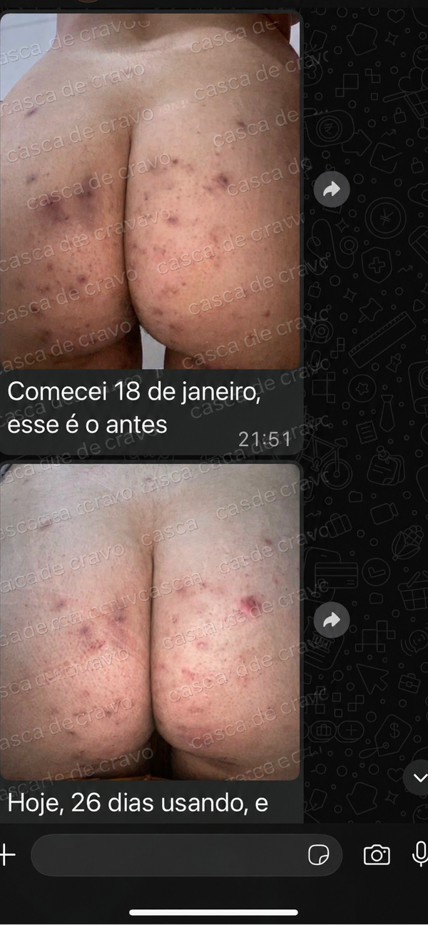 Depoimento de 