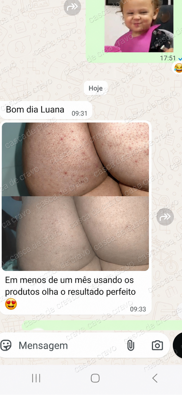 Depoimento de 