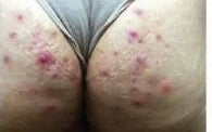 Vergonha do Corpo